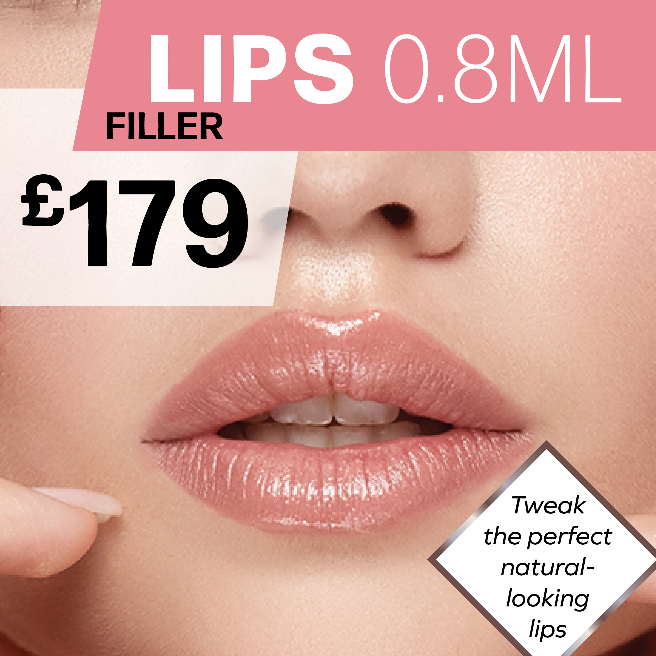 Lip Filler £179